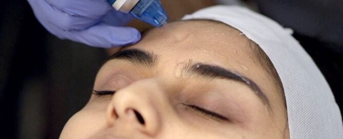 Microdermabrasion Treatment